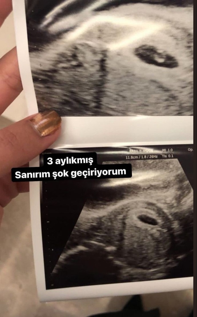 3 aylık hamileyim ne yapmalıyım?