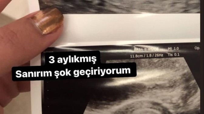 3 aylık hamileyim ne yapmalıyım?