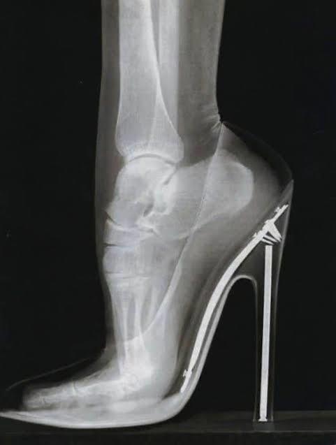 Topuklu ayakkabı kadının dişiliğini ortaya koyan bir giyim aksesuarı mıdır?