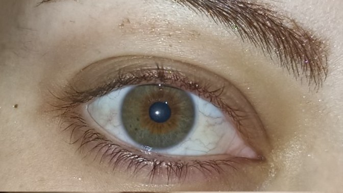 Göz rengimin lense ihtiyacı var mı?