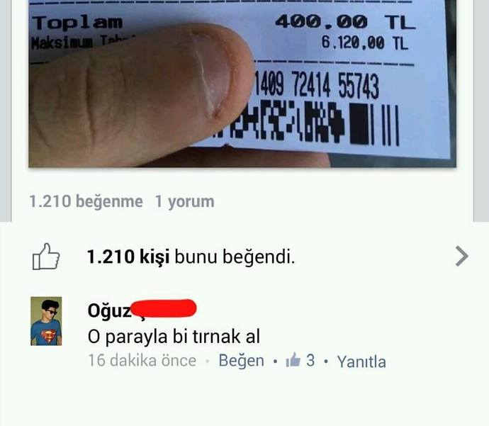 Bu parmaklarımı/tırnaklarımı nasıl düzeltirim?