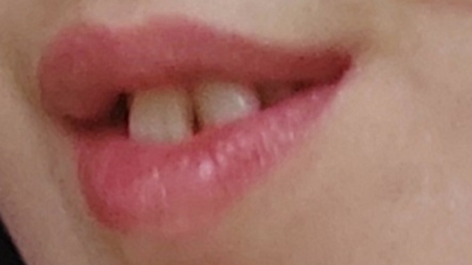 Ön dişlerim böyle çarpık ve tavşan. Evde mi kaldım?