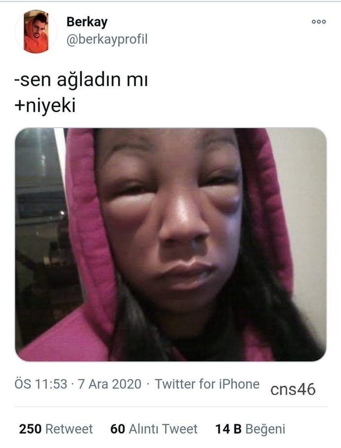 Ağladığınızda gözleriniz şişiyomu?