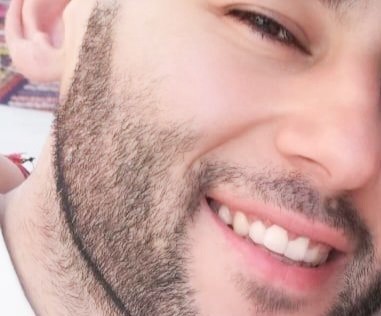 Dişlerinizi günde kaç kez fırçalıyorsunuz?
