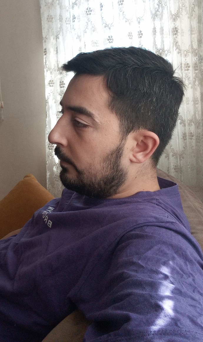 Burnum biraz kemerli ve büyük. Sizce burnumu yaptırayım mı?