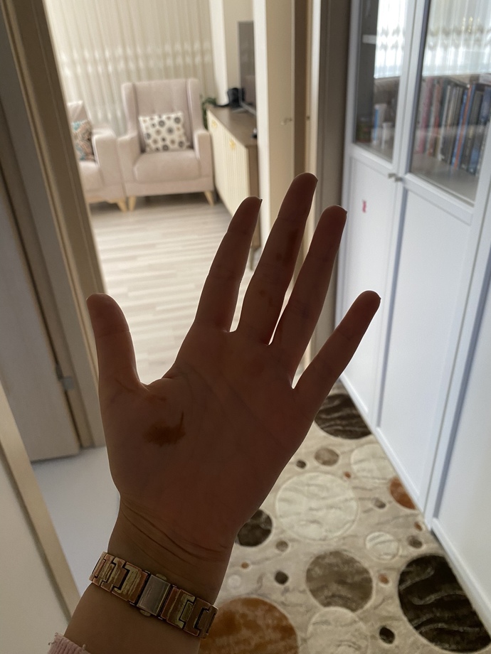 Saba uyandığımda elimde ve boynumun altında kına olduğunu fark ettim korkunç değil mi başına gelen var mı?