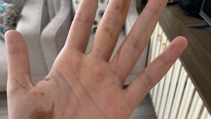 Saba uyandığımda elimde ve boynumun altında kına olduğunu fark ettim korkunç değil mi başına gelen var mı?