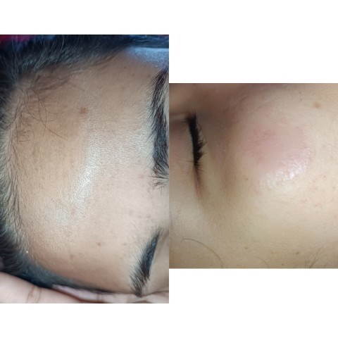 Cildimdeki lekeleri nasıl giderebilirim, önerebileceğiniz serum ya da kremler var mı?