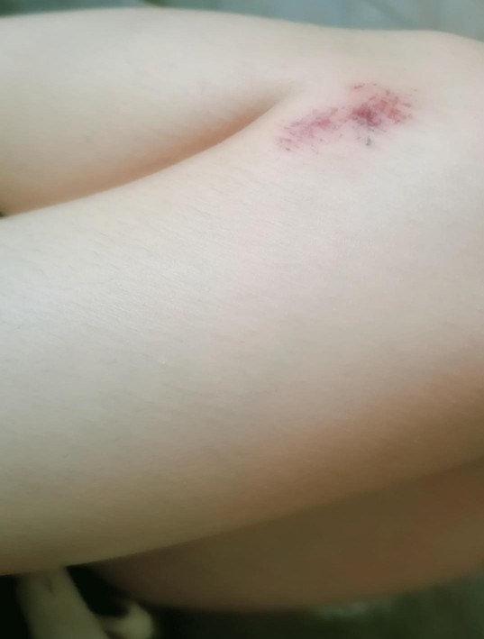 Bu yaralarin birden çıkma nedeni ne?