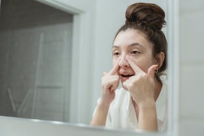 Kuru ciltlerde de sivilce olur mu?