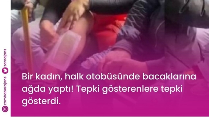 Otobüste bacaklarına ağda yapan birini görseniz ne tepki verirsiniz?