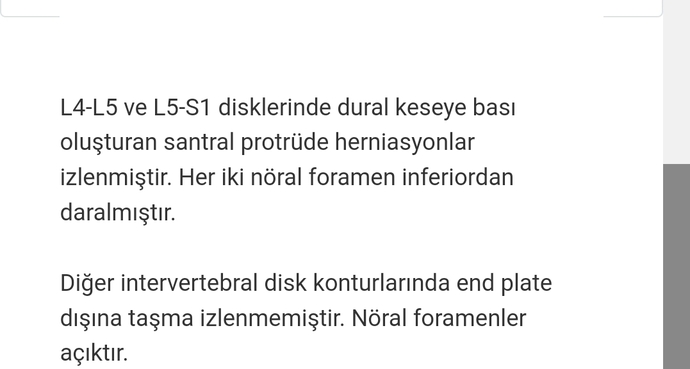Arkadaşlar mr dan anlayan var mi?