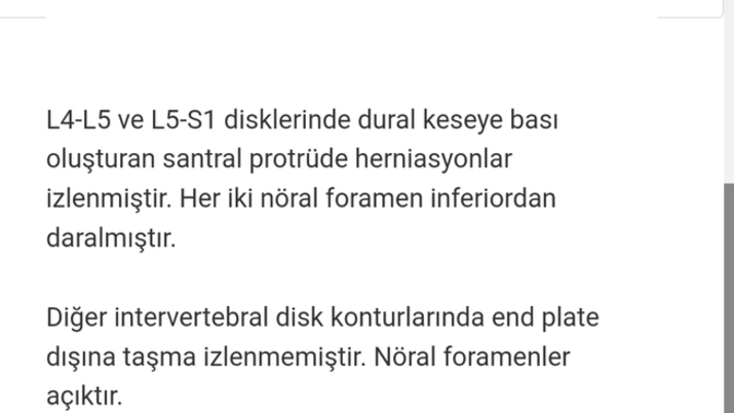 Arkadaşlar mr dan anlayan var mi?