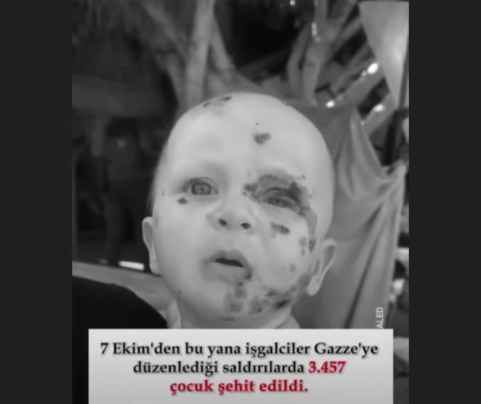Gazzenin bu hali ne olacak bu eziyete neden tüm dünya susuyor?