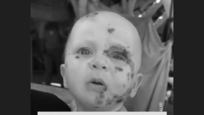 Gazze'nin bu hali ne olacak bu eziyete neden tüm dünya susuyor?