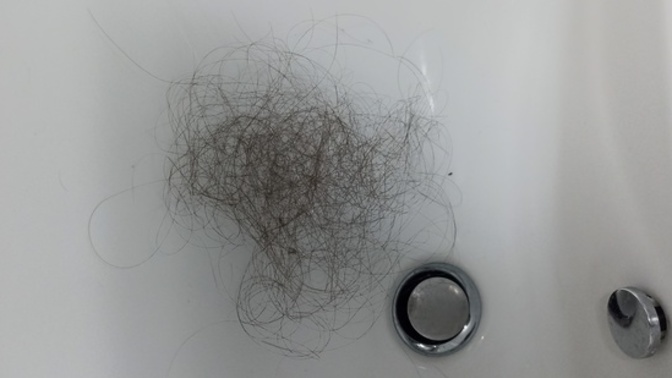 Banyo sonrası saç kaç tel dökülür?