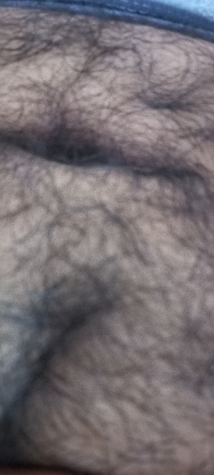 Göbek deliğimden utanıyorum, şekli çok garip durduğu için açık giyinemiyorum. Sizce normal mi?