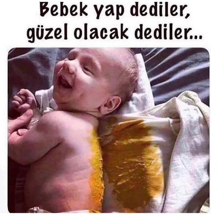 Bebek sever misiniz?