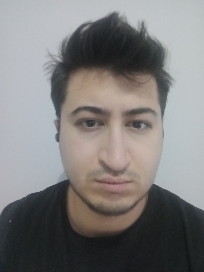 Estetik ameliyatı bu burnu düzeltir mi?