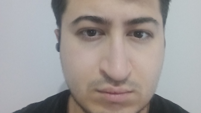 Estetik ameliyatı bu burnu düzeltir mi?