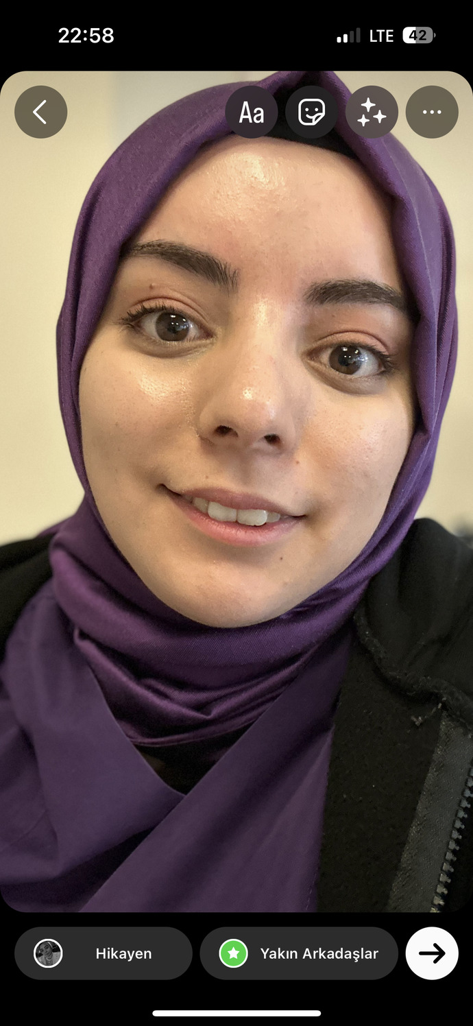 Burnum güzel mi, burun ameliyatı olmak istiyorum gerek var mı?
