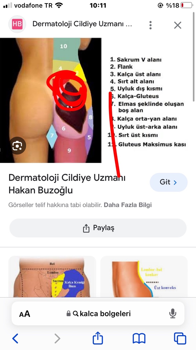 Sag kalcamın ustu cok acıyo yururken batıyo egılırken batıyo bu nedir?