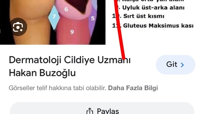 Sag kalcamın ustu cok acıyo yururken batıyo egılırken batıyo bu nedir?