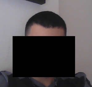 Saçlarım dökülüyor mu? Yoksa başka bir şey mi?