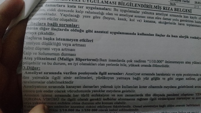 Endoskopi anestezi yan etkiler?