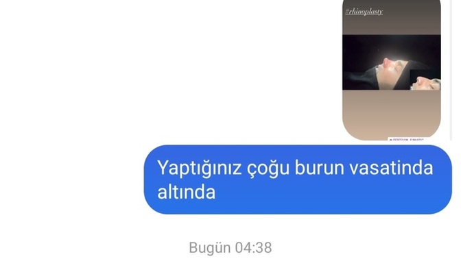 Eleştirilere açık mısın?