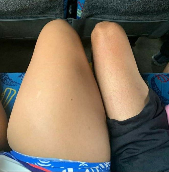 Kadınların bacakları neden erkeklerin bacaklarından daha kalın?