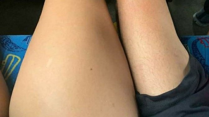 Kadınların bacakları neden erkeklerin bacaklarından daha kalın?