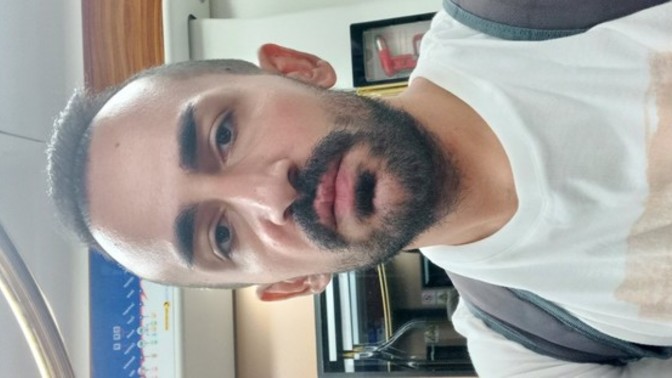 Bu yüz ifadesi insanların kalbini kırar mı?