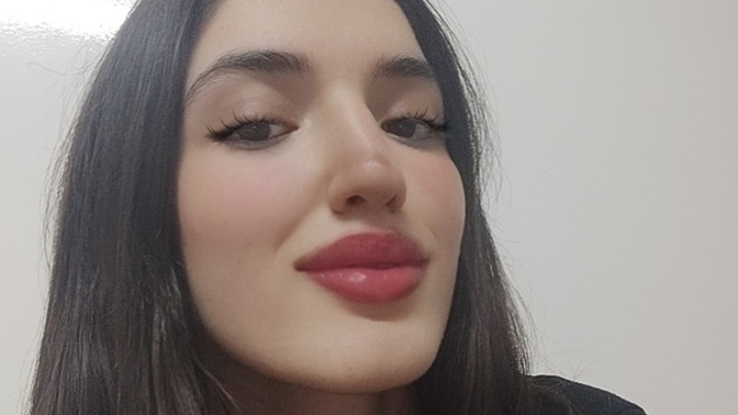 Sizce yüzüm güzelmi?