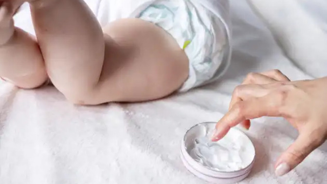 Bebeğimin pişiğini geçirmek ve önlemek için hangi kremi önerirsiniz?