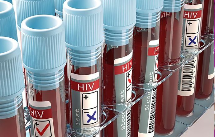 2012’den bu yana Türkiye’de HIV 4 kat artmış durumda.