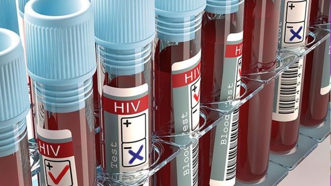 Türkiye’de HIV (Aids) 4 kat arttı... ‘Sinsi pandemi’ yine sahnede. Neler düşünüyorsunuz?