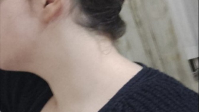 Boynumda bi anormallik var mı?