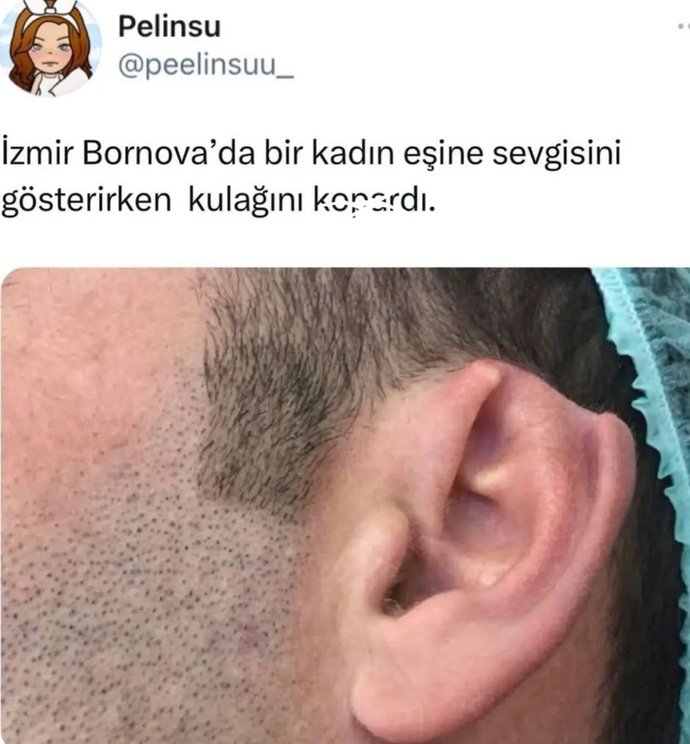 Sevginin aşırısı hoşunuza gider mi?