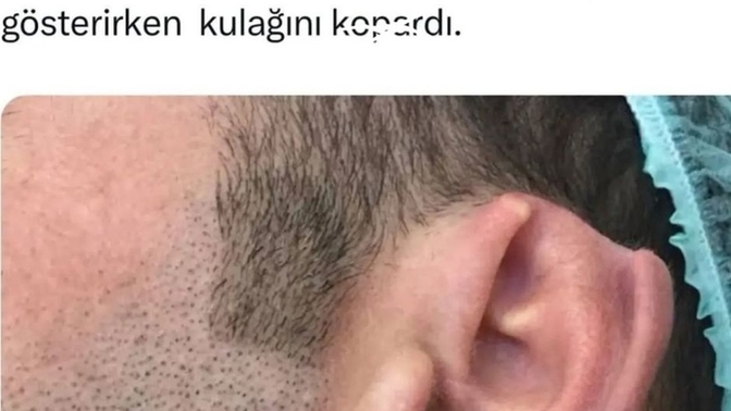 Sevginin aşırısı hoşunuza gider mi?