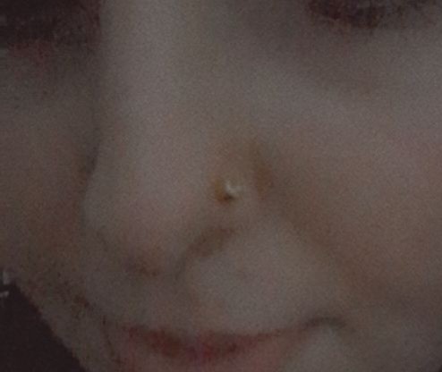 Burnumu deldirdim ama çok aşağıda olmuş. Yeniden deldirmeli miyim?