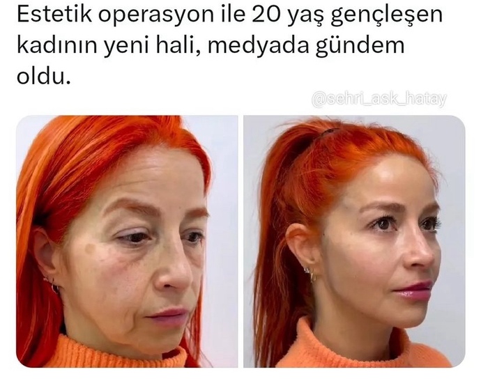 Estetik dolandırıcılık mı?