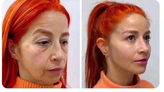Estetik dolandırıcılık mı?