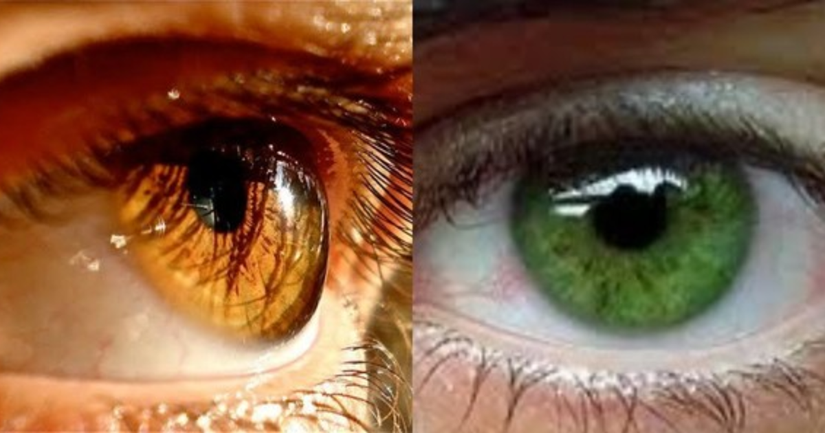 Hangi göz rengi daha çekici? Bal rengi mi gri mi yeşil mi? - KizlarSoruyor