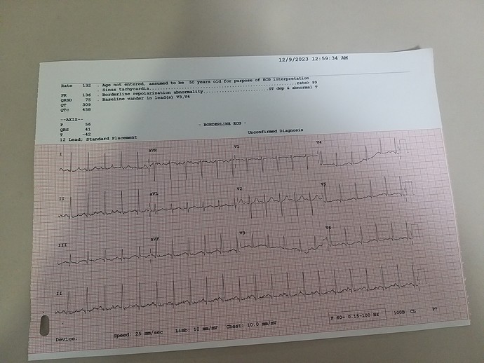 EKG sonucundan anlayanlar sonucumu bırakıyorum bakar mısınız?