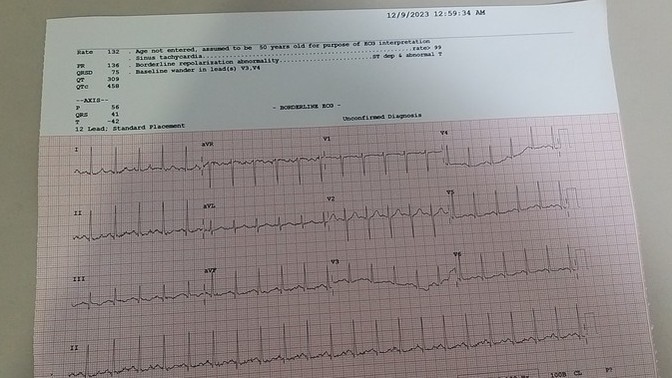 EKG sonucundan anlayanlar sonucumu bırakıyorum bakar mısınız?