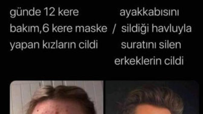 Kadınların cildi mi erkeklerin cildi mi daha temiz?