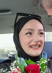Dudak dolgusu yaptırmak istiyorum yaptırsam çok fark eden olur mu?