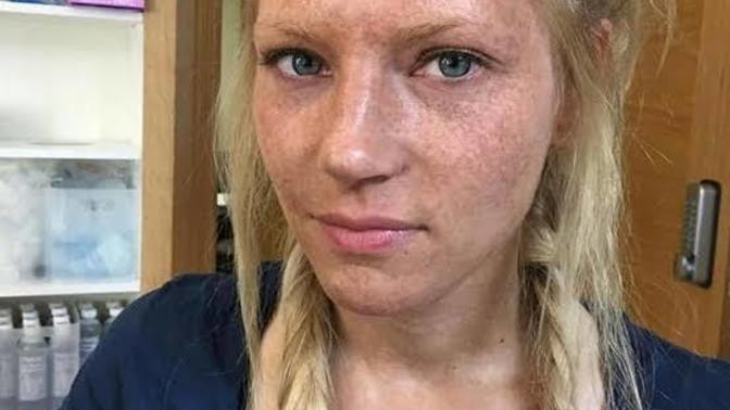 Bu kizin cildi guzel mi nasil yapilir bu ciller?