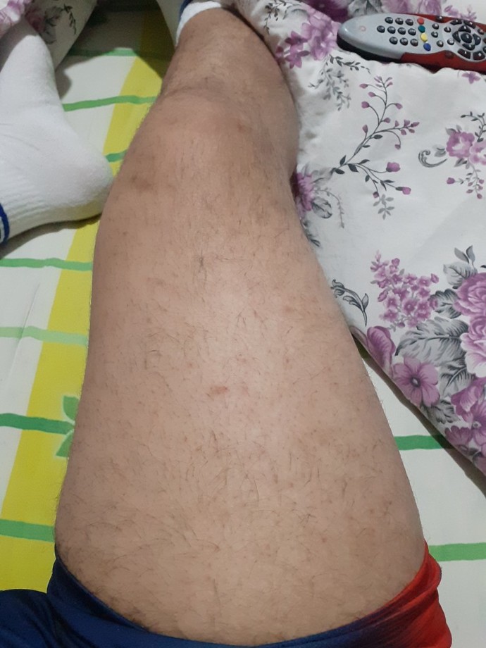 Bacağım ve kalcam cok büyük?